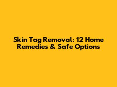 Skin Tag Removal: 12 Home Remedies & Safe Options